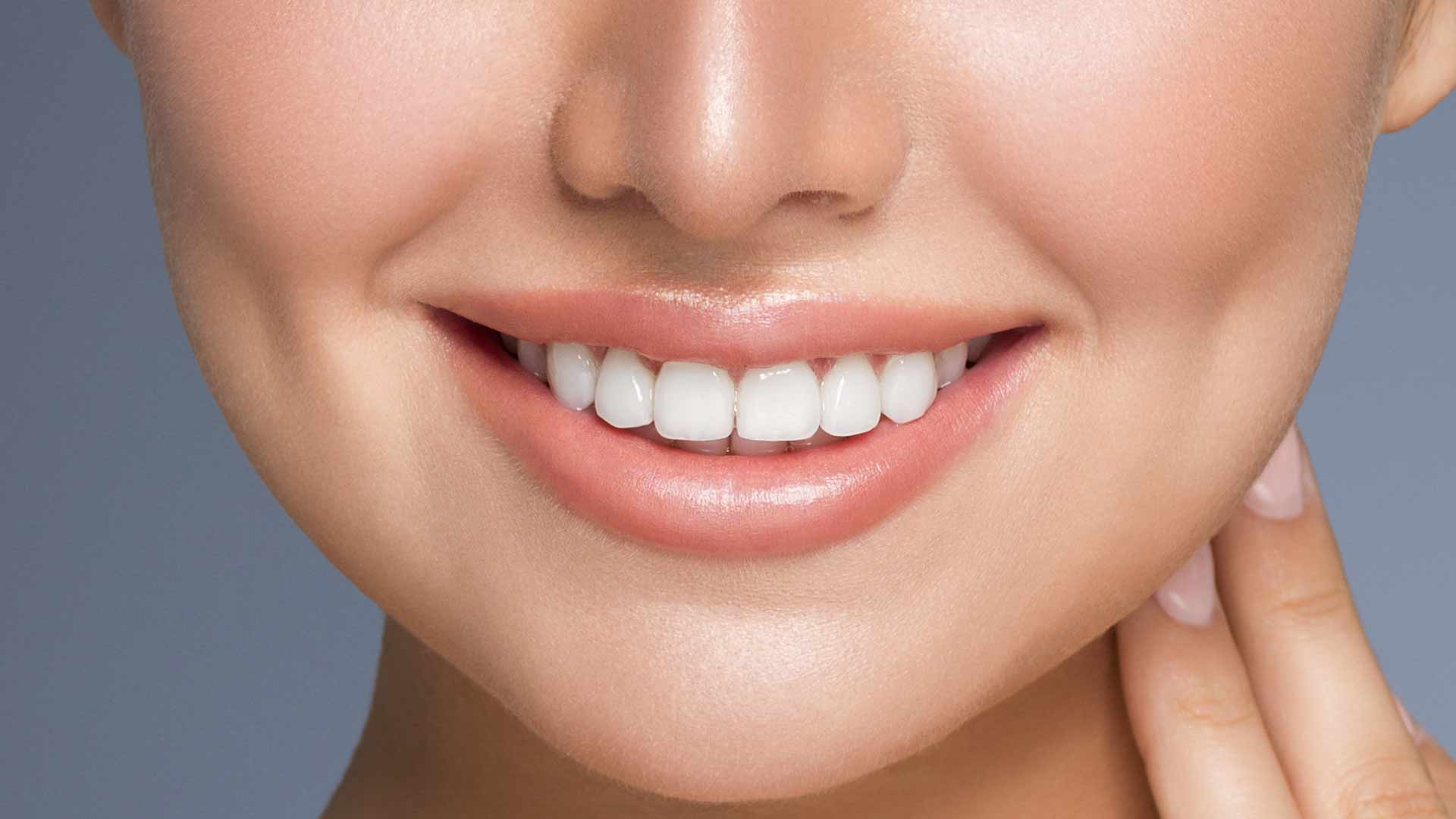 Dental veneers Dubai