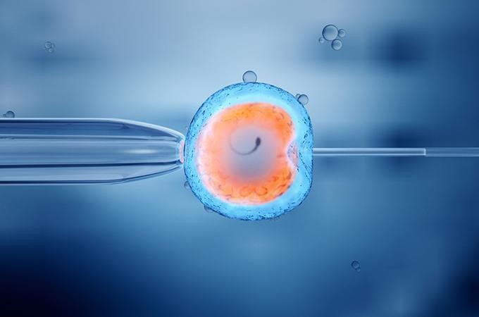 IVF Dubai